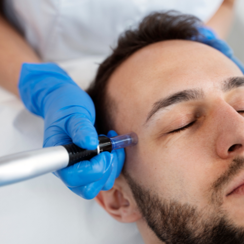 Dermapen imagen 5
