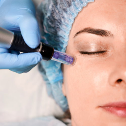 Dermapen imagen 2