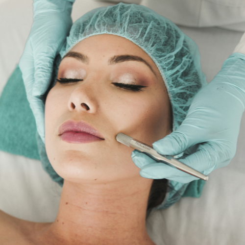 Limpieza facial con punta de diamante