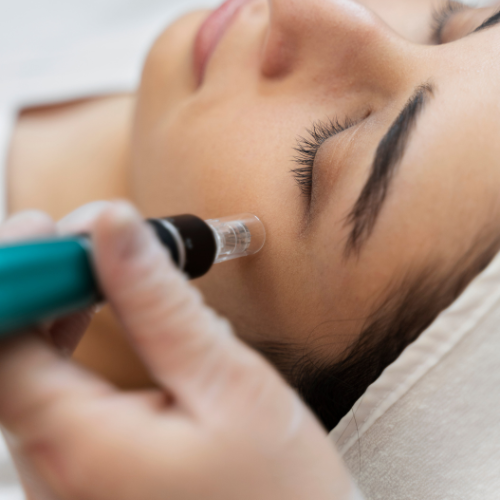 Dermapen